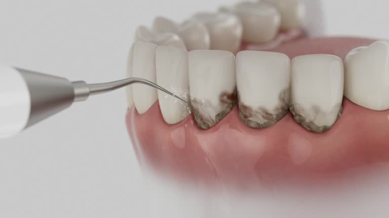 Trusted Tooth Extraction service in Santa Barbara, CA - Dentist Open Now